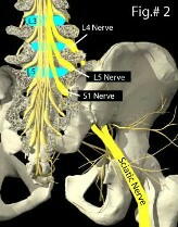 �n���_�o���獿���_�o